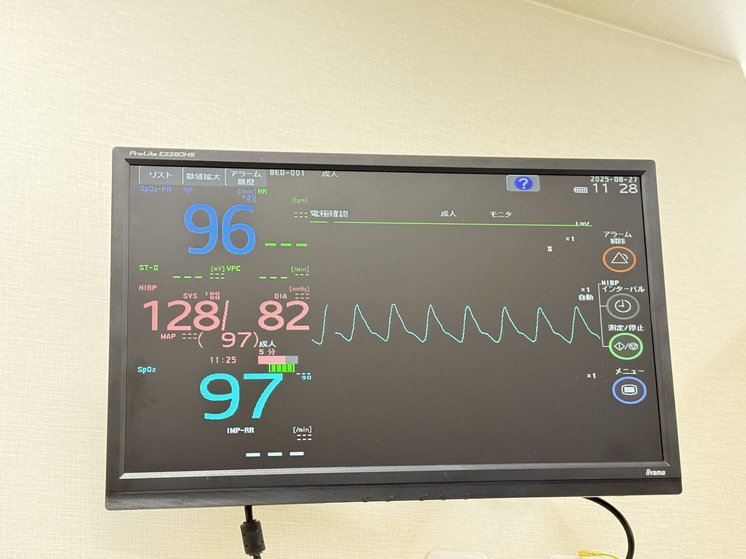 Anaphylaxis: A Medical Emergency