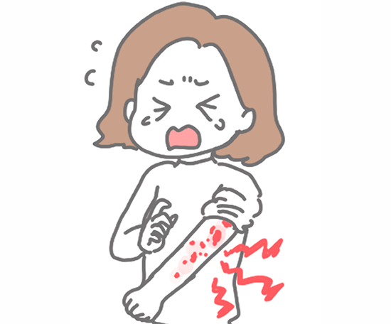 帯状疱疹と決別しよう！