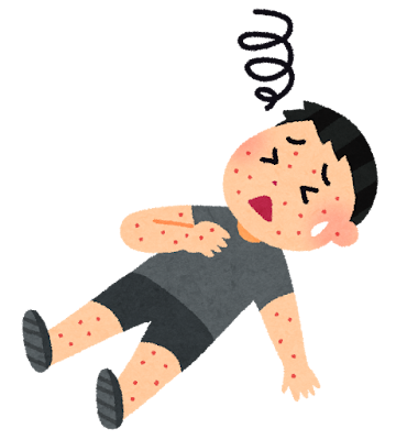 アナフィラキシーショック
